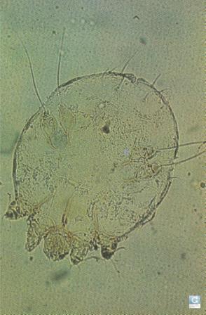 Scabies mite revealed by microscopic examination